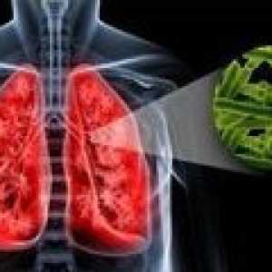Příčiny plicní tuberkulózy