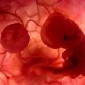 Příčiny potratů v časné fázi těhotenství