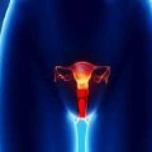 Vulvální rakoviny u žen - příčiny, diagnostika, léčba