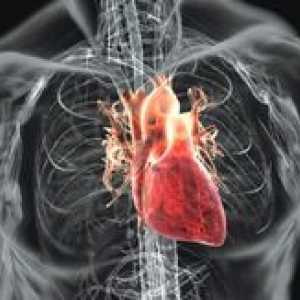 Srdce revmatismus