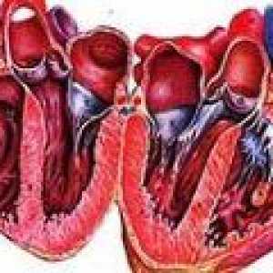 Příznaky a léčba alkoholického kardiomyopatie
