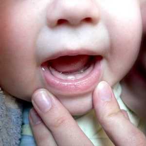 Příznaky prořezávání zubů u kojenců