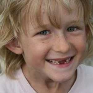Výměna zubů u dětí