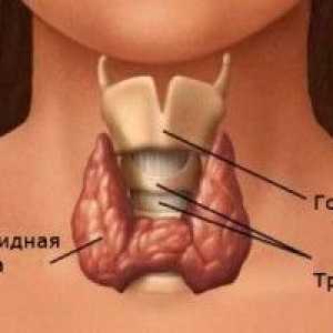 Hashimotova tyreoiditida (Hashimotova tyreoiditida) - příčiny, příznaky a léčba
