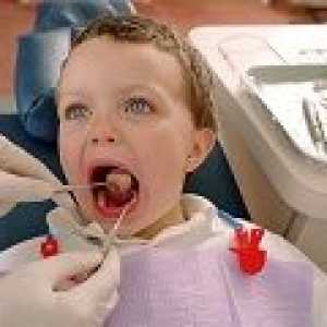 Tonzilektomie u dítěte, je možné provést bez operace?