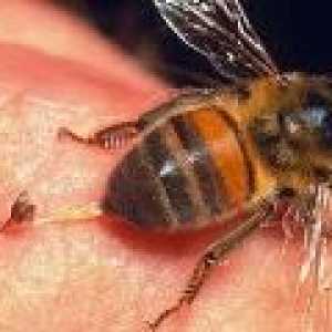 Bodnutí včely, vosy, sršně: Léčba