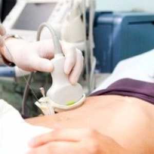 Ultrazvuková diagnostika: příprava pro studium močového měchýře