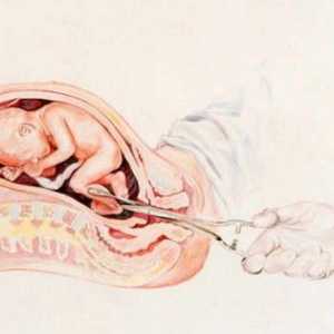Vakuum potrat: termíny