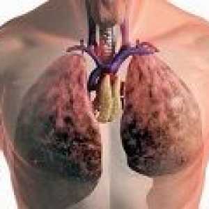 Všechna ošetření plicní tuberkulózy