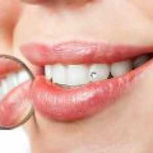 Zubní výplně - kritéria výběru